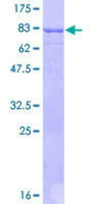 SDS-PAGE: Recombinant Human Septin-4 GST (N-Term) Protein [H00005414-P01]