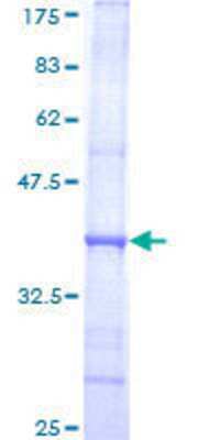 SDS-PAGE: Recombinant Human DNA polymerase alpha GST (N-Term) Protein [H00005422-Q01]