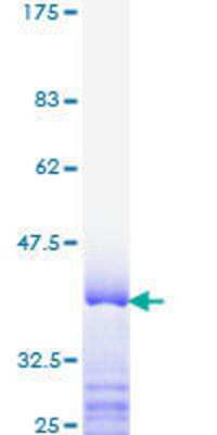 SDS-PAGE: Recombinant Human TRAP220/MED1 GST (N-Term) Protein [H00005469-Q01]