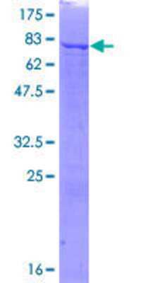 SDS-PAGE: Recombinant Human Phosphoribosyl Pyrophosphate Amidotransferase GST (N-Term) Protein [H00005471-P01]