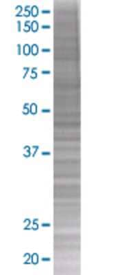 Other: CXCL7/NAP-2 293T Cell Transient Overexpression Lysate [H00005473-T01]