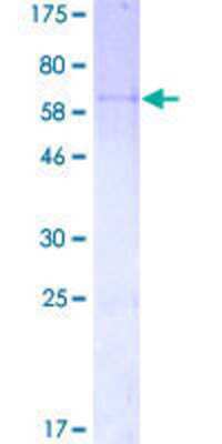 SDS-PAGE: Recombinant Human PPP1R3C GST (N-Term) Protein [H00005507-P01]