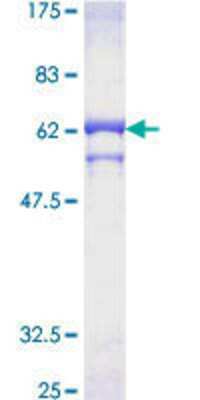 SDS-PAGE: Recombinant Human PPP2CB GST (N-Term) Protein [H00005516-P01]