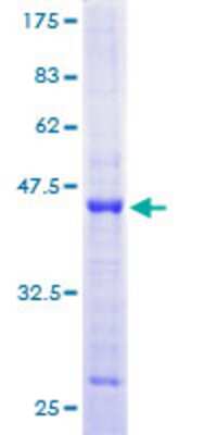 SDS-PAGE: Recombinant Human DNA Primase large subunit GST (N-Term) Protein [H00005558-P01]