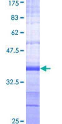 SDS-PAGE: Recombinant Human AMPK alpha 2 GST (N-Term) Protein [H00005563-Q01]