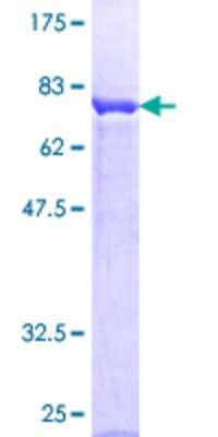 SDS-PAGE: Recombinant Human Protein Kinase A regulatory subunit I alpha GST (N-Term) Protein [H00005573-P01]