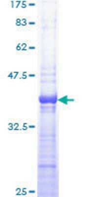 SDS-PAGE: Recombinant Human Protein Kinase A regulatory subunit I alpha GST (N-Term) Protein [H00005573-Q01]