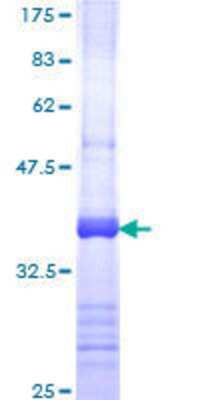 SDS-PAGE: Recombinant Human PKC theta GST (N-Term) Protein [H00005588-Q01]