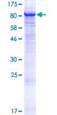 SDS-PAGE: Recombinant Human PKC zeta GST (N-Term) Protein [H00005590-P01]