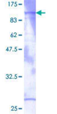 SDS-PAGE: Recombinant Human cGK1/PRKG1 GST (N-Term) Protein [H00005592-P01]