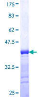 SDS-PAGE: Recombinant Human cGK1/PRKG1 GST (N-Term) Protein [H00005592-Q01]