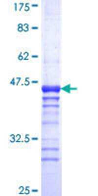 SDS-PAGE: Recombinant Human Presenilin-2 GST (N-Term) Protein [H00005664-Q01]