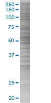 Other: PTEN 293T Cell Transient Overexpression Lysate [H00005728-T02]