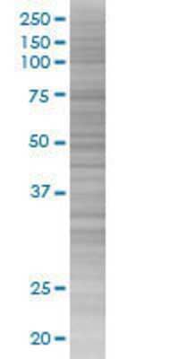 Other: PTGER2 293T Cell Transient Overexpression Lysate [H00005732-T01]
