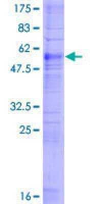 SDS-PAGE: Recombinant Human PTGFR GST (N-Term) Protein [H00005737-P01]