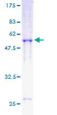 SDS-PAGE: Recombinant Human Rad51 GST (N-Term) Protein [H00005888-P01]