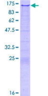 SDS-PAGE: Recombinant Human RAG1 GST (N-Term) Protein [H00005896-P01]