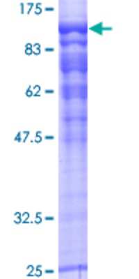 SDS-PAGE: Recombinant Human RAP1GAP GST (N-Term) Protein [H00005909-P01]