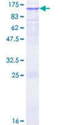 SDS-PAGE: Recombinant Human Ras-GAP GST (N-Term) Protein [H00005921-P01]