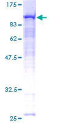 SDS-PAGE: Recombinant Human Radixin GST (N-Term) Protein [H00005962-P01]