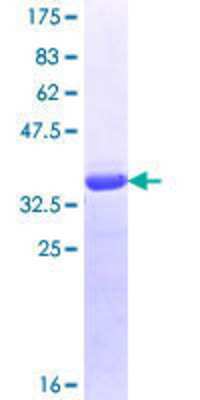 SDS-PAGE: Recombinant Human RENT1/UPF1/hUPF1 GST (N-Term) Protein [H00005976-Q01]