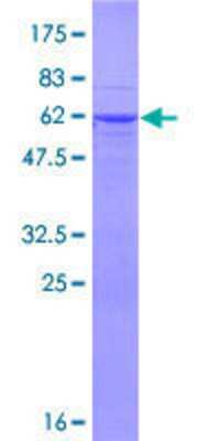 SDS-PAGE: Recombinant Human RFPL1 GST (N-Term) Protein [H00005988-P01]