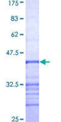 SDS-PAGE: Recombinant Human RPGR GST (N-Term) Protein [H00006103-Q01]