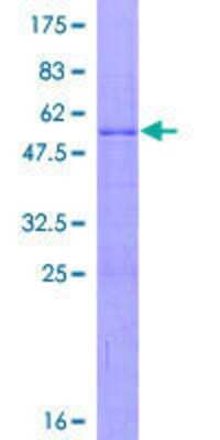 SDS-PAGE: Recombinant Human RPL15 GST (N-Term) Protein [H00006138-P01]