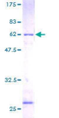 SDS-PAGE: Recombinant Human RPLP0 GST (N-Term) Protein [H00006175-P01]