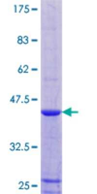 SDS-PAGE: Recombinant Human RPLP1 GST (N-Term) Protein [H00006176-P01]