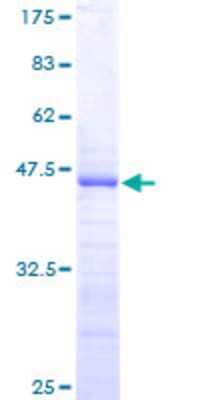 SDS-PAGE: Recombinant Human RPS17 GST (N-Term) Protein [H00006218-P02]