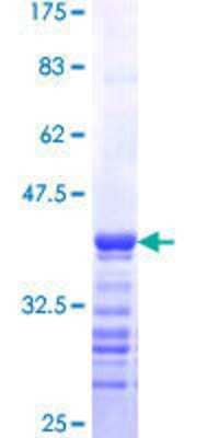 SDS-PAGE: Recombinant Human RTKN GST (N-Term) Protein [H00006242-Q01]