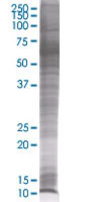 Other: S100A2 293T Cell Transient Overexpression Lysate [H00006273-T01]