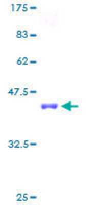 SDS-PAGE: Recombinant Human Sterol carrier protein 2 GST (N-Term) Protein [H00006342-P01]