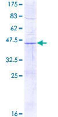 SDS-PAGE: Recombinant Human SDHD GST (N-Term) Protein [H00006392-P01]