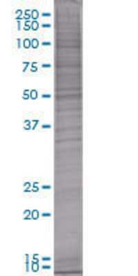 Other: SC35 293T Cell Transient Overexpression Lysate [H00006427-T01]
