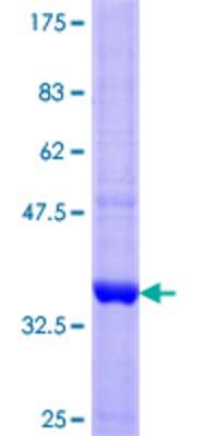 SDS-PAGE: Recombinant Human alpha-Sarcoglycan GST (N-Term) Protein [H00006442-Q01]