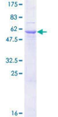 SDS-PAGE: Recombinant Human gamma Sarcoglycan GST (N-Term) Protein [H00006445-P01]