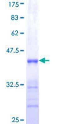 SDS-PAGE: Recombinant Human SHOX2 GST (N-Term) Protein [H00006474-Q01]