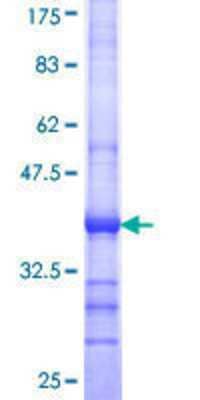 SDS-PAGE: Recombinant Human SKIV2L GST (N-Term) Protein [H00006499-Q01]