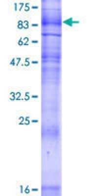 SDS-PAGE: Recombinant Human SGLT2/SLC5A2 GST (N-Term) Protein [H00006524-P01]