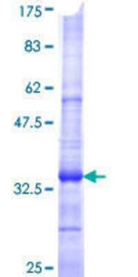 SDS-PAGE: Recombinant Human SLC6A3/DAT1 GST (N-Term) Protein [H00006531-Q01]