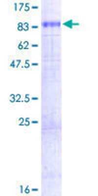 SDS-PAGE: Recombinant Human CAT1 GST (N-Term) Protein [H00006541-P01]