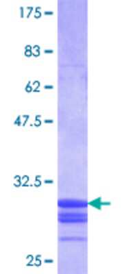 SDS-PAGE: Recombinant Human NRAMP1/SLC11A1 GST (N-Term) Protein [H00006556-Q01]