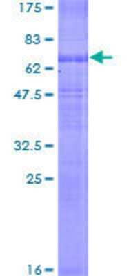 SDS-PAGE: Recombinant Human NKCC2/SLC12A1 GST (N-Term) Protein [H00006557-P01]