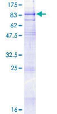 SDS-PAGE: Recombinant Human SLC34A1 GST (N-Term) Protein [H00006569-P01]