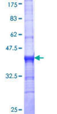 SDS-PAGE: Recombinant Human VMAT2 GST (N-Term) Protein [H00006571-Q01]