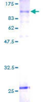 SDS-PAGE: Recombinant Human SLC20A1 GST (N-Term) Protein [H00006574-P01]