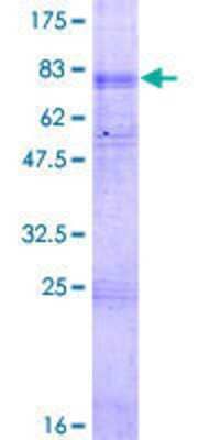 SDS-PAGE: Recombinant Human OCTN2/SLC22A5 GST (N-Term) Protein [H00006584-P01]