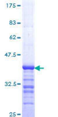 SDS-PAGE: Recombinant Human SNF5 GST (N-Term) Protein [H00006598-Q01]